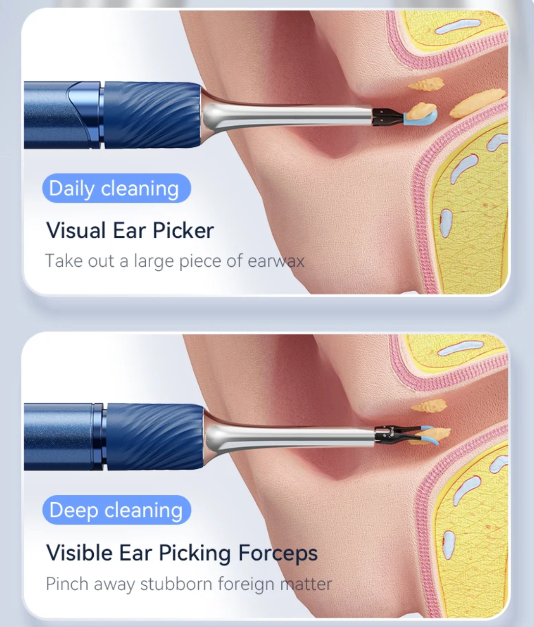 Visual Ear Cleaning Camera 12MP with EarCare Picks Tweezers & 6 Silicone Spoons