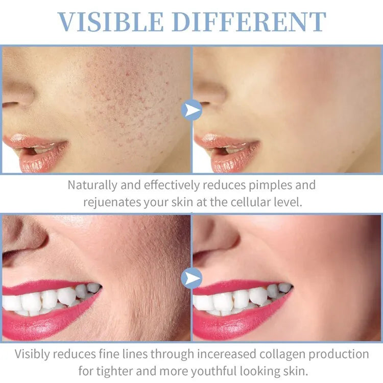 4-in-1 High Frequency Beauty Wand – Facial Massage Device for Skin Firming and Glow