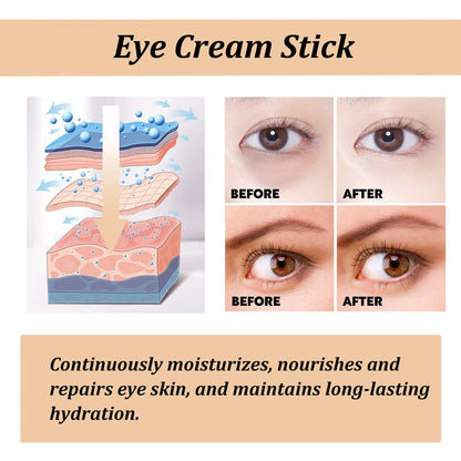 Hydrating Formula Snail Collagen Eye Cream Stick for Puffiness, Dark Circles & Fine Lines