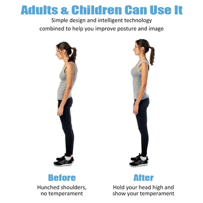 Smart Posture Corrector Belt Sensor for Kids & Adults – Improved Sitting Alignment with Invisible Reminder