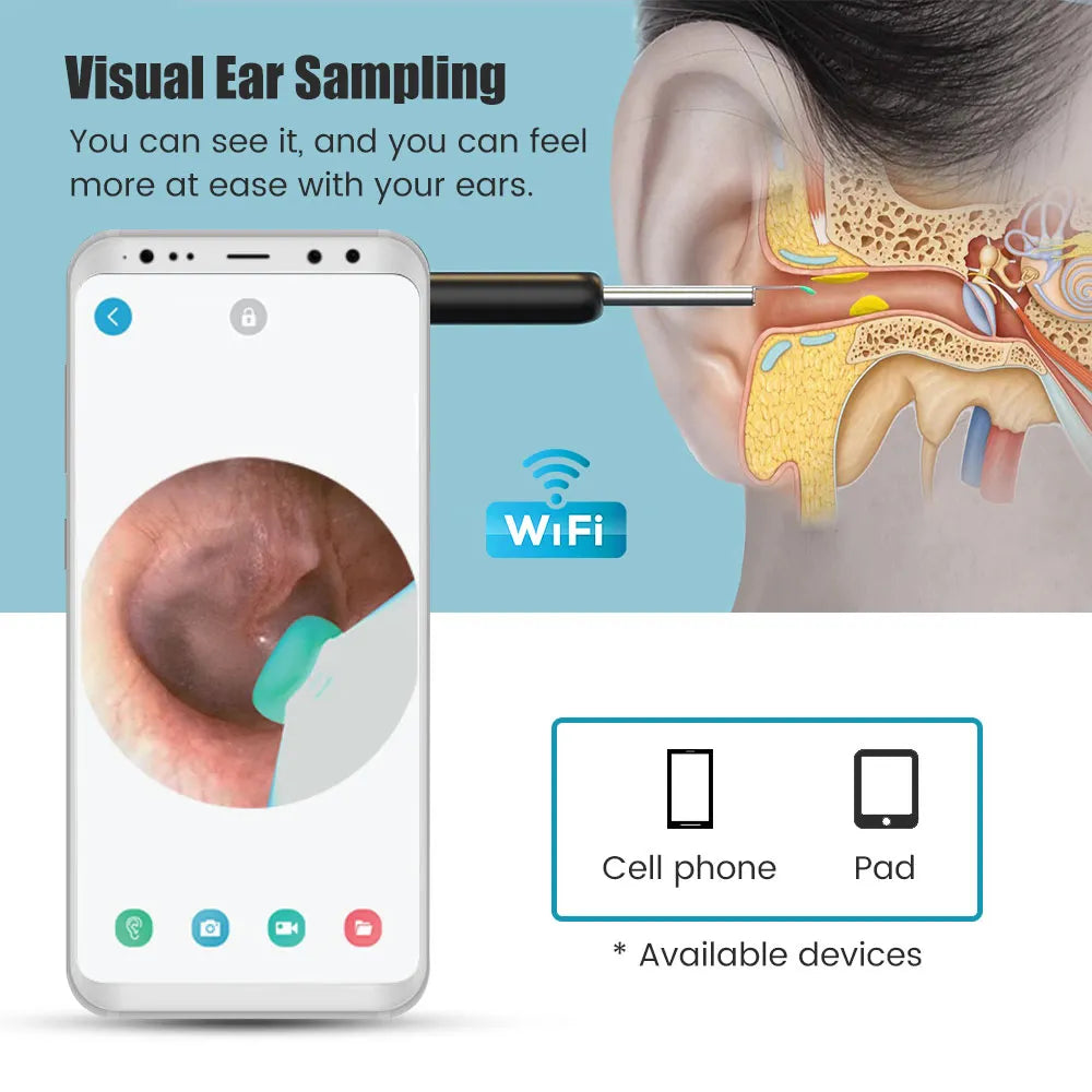 SALORIE Wireless Smart Visual Ear Cleaning Endoscope